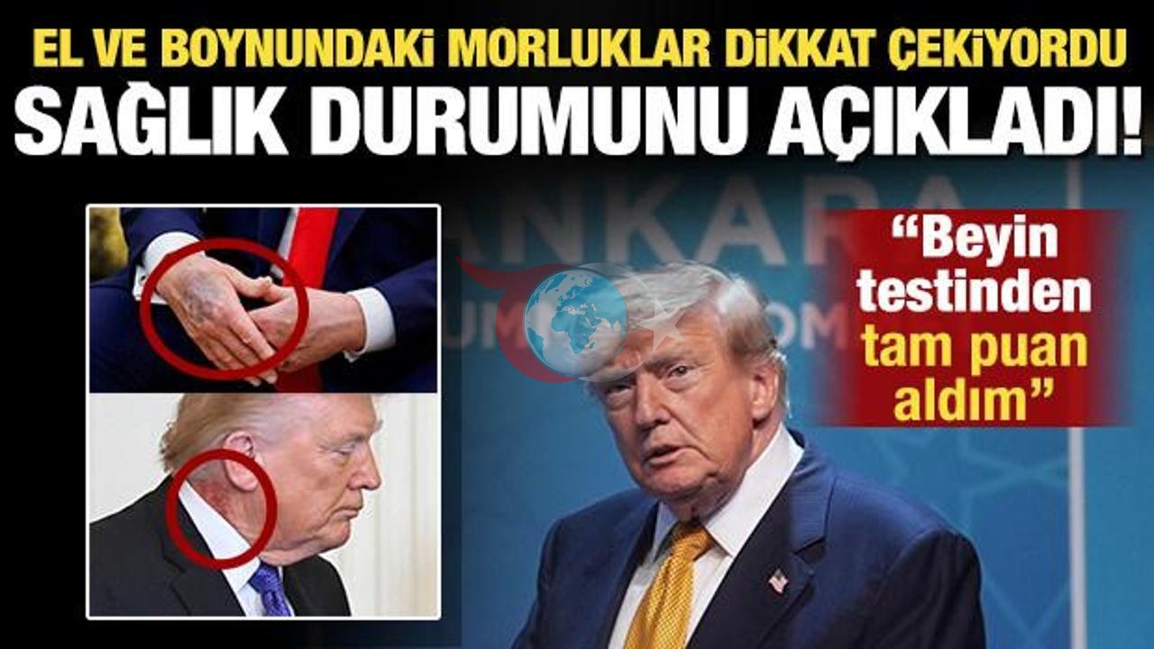 Donald Trump'tan Sağlık Durumu Açıklaması: "Bilişsel Testten Yine Tam Puan Aldım"