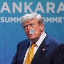 Trump'ın sağlık durumu nasıl? Boynundaki morluklar dikkat çekmişti: 'Tam puan aldım'