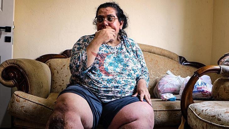 Adana'da Fil Hastalığı Pençesindeki Anneden Yardım Çığlığı: "Çocuklarım İçin Yaşamak İstiyorum"