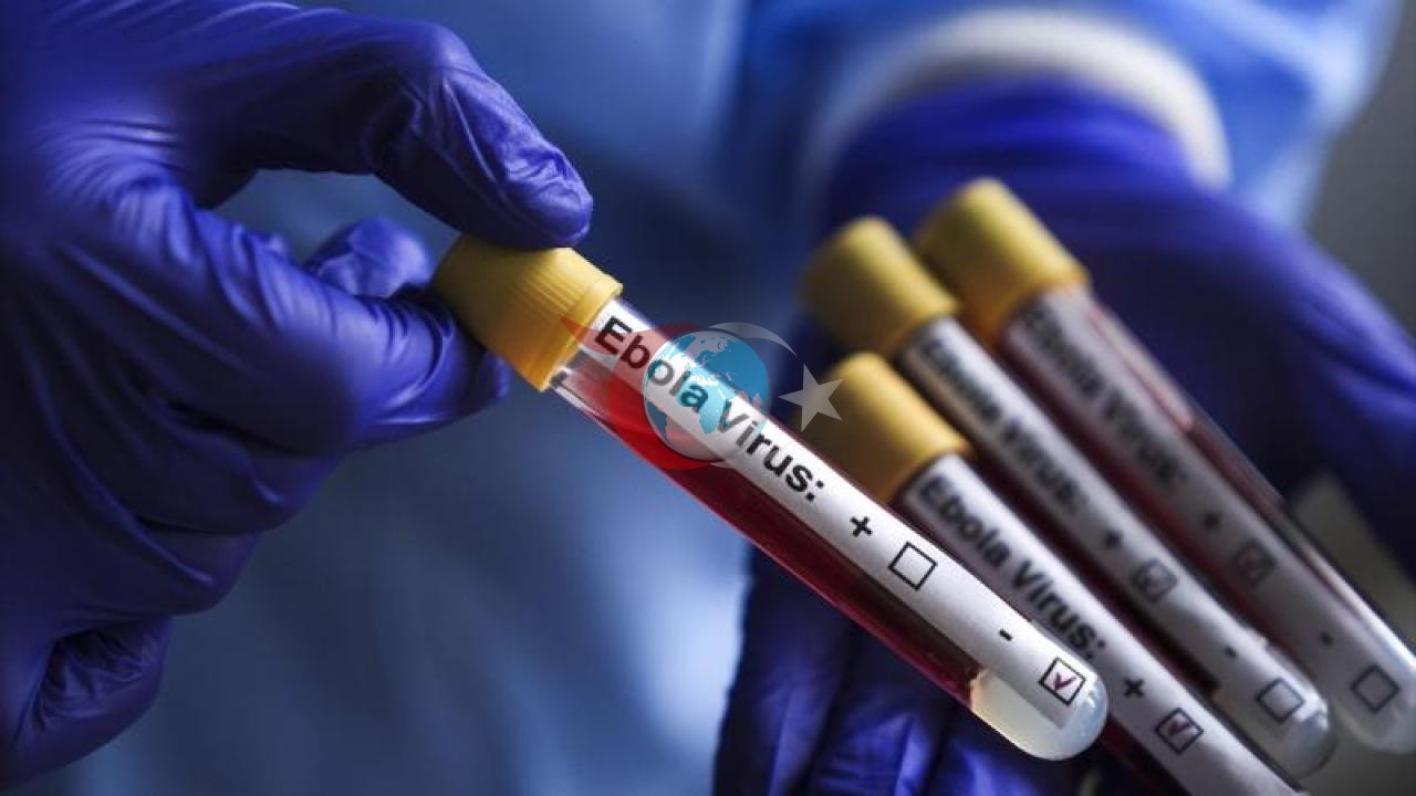 Ebola'nın En Ölümcül Türüne Karşı Tarihi Adım: Yeni Nesil Aşı İlk Kez İnsanda Denendi