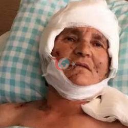 Kyrşehirde it tarapyndan hüjüm edilen 63 ýaşly aýala kompensasiýa tölener