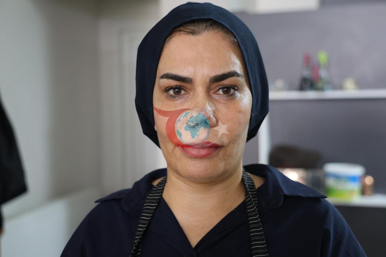 Onun baxım mərkəzində burnu qırıldı və sağalmalı olduğu 4 əməliyyatdan sonra həyatı kabusa çevrildi.