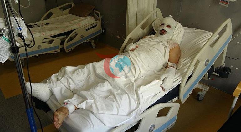 Hatay’da dehşet Mumyaya döndü: Başımızın üstündeki lamba ve yerdeki telefon patladı