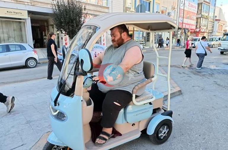 4 yıldır fil hastalığıyla mücadele ediyor Yürümek için 82 kilo vermesi gerekiyor
