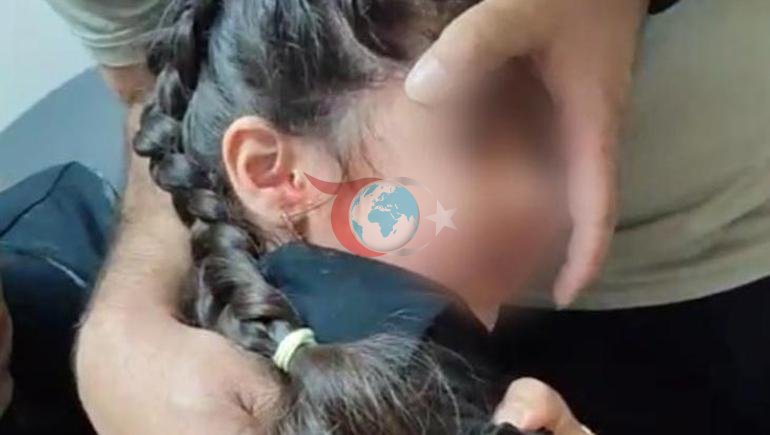 Bir aydır kulak ağrısı çekiyordu Kulağında canlı kene bulundu