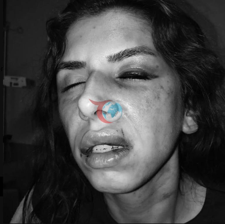 Çekmeköydə arvadını döydü, hədələdi və təhqir etdi. Məhkəmədən həbs qərarı