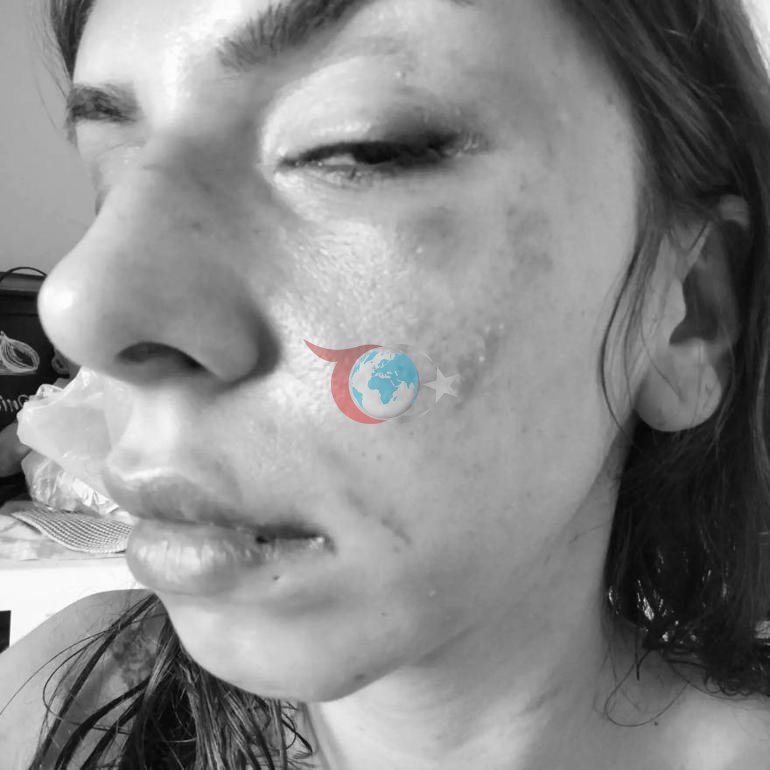 Çekmeköydə arvadını döydü, hədələdi və təhqir etdi. Məhkəmədən həbs qərarı