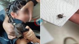 O, bir aydır qulaq ağrısından əziyyət çəkirdi! Qulağında canlı gənə tapılıb=