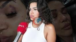 Kaçtı, uzaklaştırma kararı aldırdı yine de kurtulamadı! Ebru hemşirenin kabusu: Benden kurtulmanın tek yolu beni öldürmen