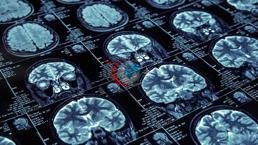 45 жастан асқандарға назар аударыңыз! Ойынды өзгертетін зерттеулер: '3 жаста қарапайым әдеттерден арылуға болады. ені = 