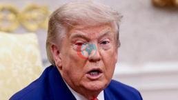 Trump, Kazma Dağı'nı işaret etti: Yakında vurabiliriz