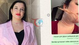 Qoşa çənəni çıxartma əməliyyatı onun həyatını kabusa çevirdi: O qədər şişkinlik var ki, sinif çox yüklənəcək=
