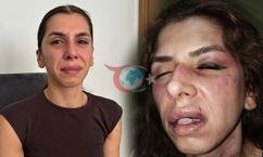 Аны аялы 4 саат кыйнады, тамагына бычак такалды деп ойлодум.