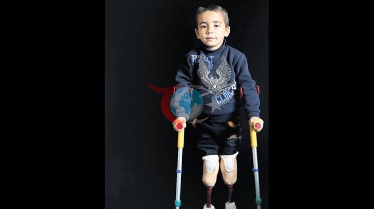 Adidastan vicdanları yaralayan reklam… Bunlar da İsrail’in sakat bıraktığı Gazzeli çocuklar