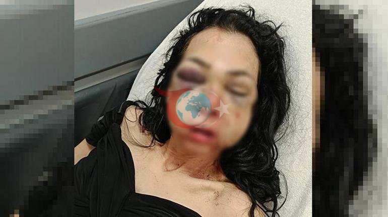 İzmitdə kafedə dava Qadının üzünə külqabı və stəkan atdı