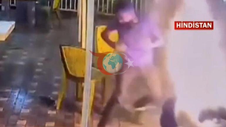 Balayı tatili kabusa döndü Genç kadın mangal ateşiyle böyle yandı