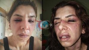 Istanbulda terror Xotinini soatlab kaltaklagani va xotinini pichoq bilan qo'rqitgani haqidagi iddao: Istanbulda shahid bo'lishi uchun olib keling