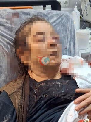 Kayseri Melikgazi'de evdeki tavan sıvası çöktü: 75 yaşındaki kadın gözünü kaybetti - görsel 3