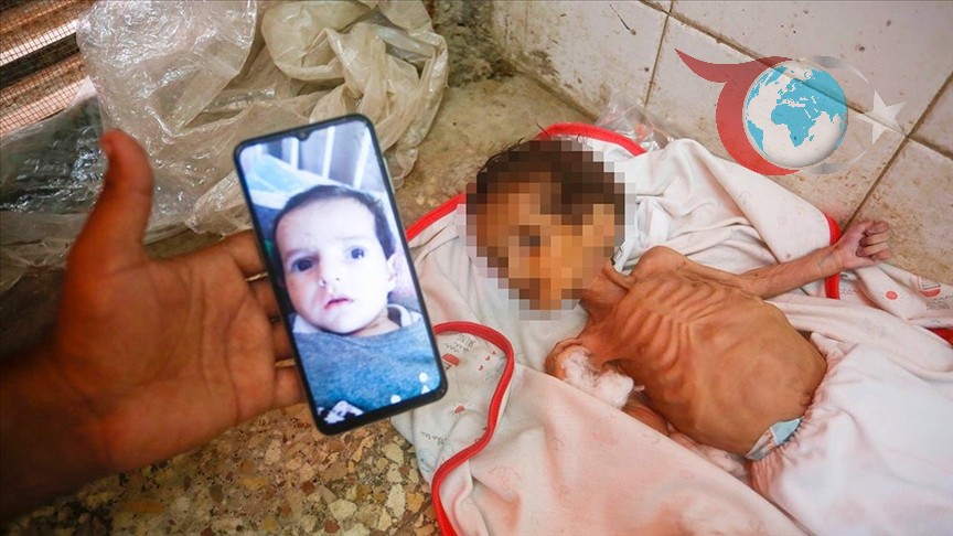 Gazze'de Mama Bulamadığı İçin Hayatını Kaybeden Bebekler