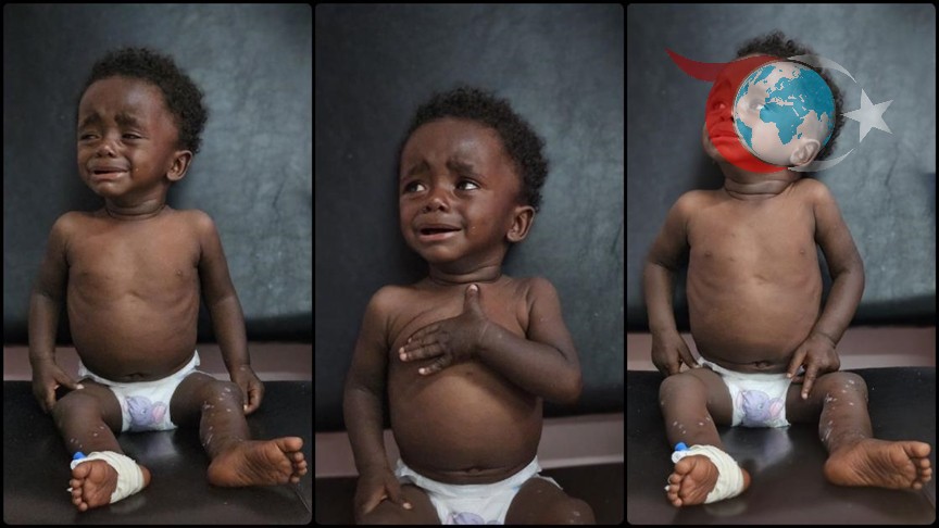 Gazze'deki Yetersiz Beslenme Krizi Binlerce Çocuğu Tehdit Ediyor