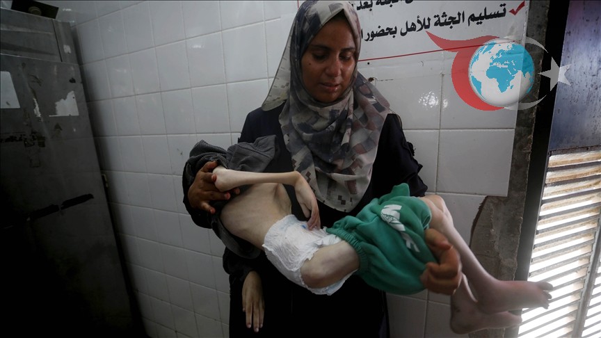 Gazze’de Kıtlık ve Abluka Nedeniyle Artan Trajedi